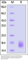 Mouse TSPAN8 Protein, His Tag (MALS verified)