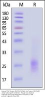 Human TSLP Protein (R127A, R130A), His Tag (MALS verified)