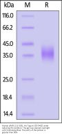 Human uPAR / PLAUR (112-303) Protein, His Tag