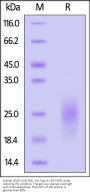Human uPAR / PLAUR (209-303) Protein, His Tag