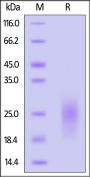 Human uPAR / PLAUR (209-303) Protein, His Tag