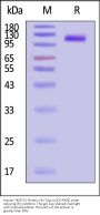 Human VEGF R1 / Flt-1 Protein, His Tag (MALS verified)