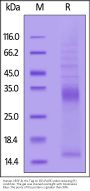 Human VEGF-B Protein, His Tag