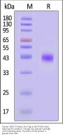 Human VEGF-C / Flt4-L Protein, His Tag (MALS verified)