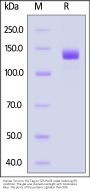 Human Vinculin / VCL Protein, His Tag