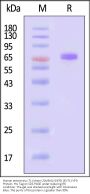 Human enterovirus 71 (strain USA/BrCr/1970) (EV71) VP0 Protein, His Tag