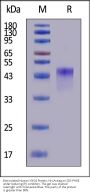Biotinylated Human VSIG4 Protein, His,Avitag™ (MALS verified)