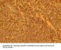 CCR4 Antibody (OASA06082)