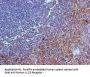 IL23R antibody - N-terminal region (OASA06290)