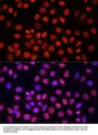 Histone H3(mono+di+methyl K79) Antibody