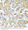 Tumor Necrosis Factor Receptor Superfamily Member 1A / CD120a (TNFRSF1A) Antibody