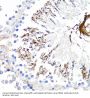 Tumor Necrosis Factor Receptor Superfamily Member 1A / CD120a (TNFRSF1A) Antibody