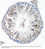 Tumor Necrosis Factor Receptor Superfamily Member 1A / CD120a (TNFRSF1A) Antibody