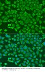 Albumin (ALB) Antibody