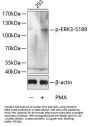 Mitogen-Activated Protein Kinase 6 Phospho-Ser189 (MAPK6 pS189) Antibody