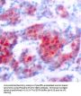Signal Transducer and Activator of Transcription 4 Phospho-Tyr693 (STAT4 pY693) Antibody