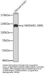 Glutamate Receptor Ionotropic, NMDA 1 Phospho-Ser896 (GRIN1 pS896) Antibody