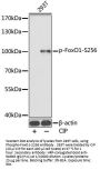 FOXO1 (pS256) Antibody