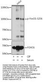 FOXO1 (pS256) Antibody