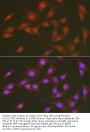 FOXO1 (pS256) Antibody