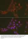 FOXO1 (pS256) Antibody