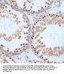 Breast Cancer Type 1 Susceptibility Protein Phospho-Ser1423 (BRCA1 pS1423) Antibody