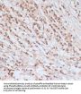 Breast Cancer Type 1 Susceptibility Protein Phospho-Ser1423 (BRCA1 pS1423) Antibody