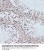 Breast Cancer Type 1 Susceptibility Protein Phospho-Ser1423 (BRCA1 pS1423) Antibody