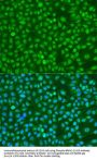 Breast Cancer Type 1 Susceptibility Protein Phospho-Ser1423 (BRCA1 pS1423) Antibody
