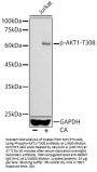 RAC-Alpha Serine/threonine-Protein Kinase Phospho-Thr308 (AKT1 pT308) Antibody