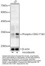 CDK2 (pT160) Antibody