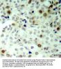 CDK2 (pT160) Antibody