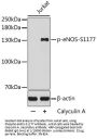NOS3 (pS1177) Antibody