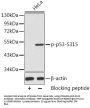 TP53 (pS315) Antibody