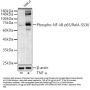 RELA (pS536) Antibody