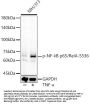 RELA (pS536) Antibody