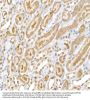 RELA (pS536) Antibody