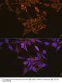Vascular Endothelial Growth Factor Receptor 1 (FLT1) Antibody