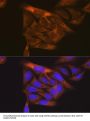 Vascular Endothelial Growth Factor Receptor 1 (FLT1) Antibody