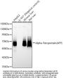 Alpha-Fetoprotein (AFP) Antibody
