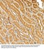 Cyclic AMP-Dependent Transcription Factor ATF-6 Alpha (ATF6) Antibody