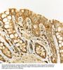 Cyclic AMP-Dependent Transcription Factor ATF-6 Alpha (ATF6) Antibody