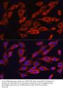 Cyclic AMP-Dependent Transcription Factor ATF-6 Alpha (ATF6) Antibody