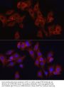Cyclic AMP-Dependent Transcription Factor ATF-6 Alpha (ATF6) Antibody
