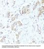 Bcl2 Associated X Protein (BAX) Antibody