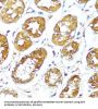 Bcl2 Associated X Protein (BAX) Antibody