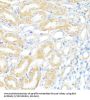 Bcl2 Associated X Protein (BAX) Antibody