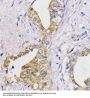 Apoptosis Regulator Bcl-2 (BCL2) Antibody
