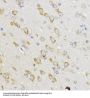 Apoptosis Regulator Bcl-2 (BCL2) Antibody