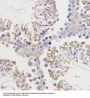 Apoptosis Regulator Bcl-2 (BCL2) Antibody